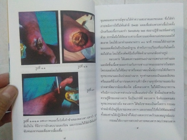 "บันทึกปัจฉิมอาพาธหลวงตามหาบัว ญาณสัมปันโน" โดย ศาสตราจารย์ นายแพทย์ นิพนธ์ พวงวรินทร์